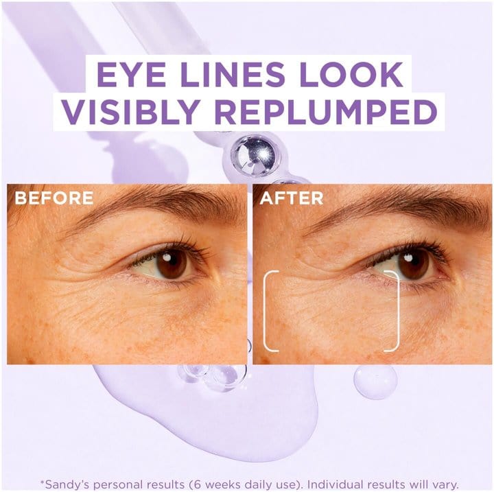 Loreal Paris Serum Revitalift Filler Hyaluronic Acid Eye Serum 20 ml 2 Pack