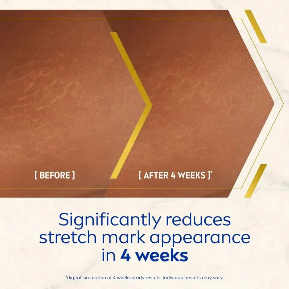 Nivea Luminous 630 Anti-Stretch Mark Body Oil Serum 100ml / 3.4 fl oz